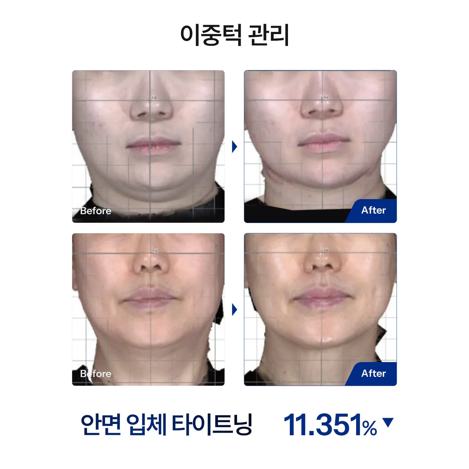 HOMEMODE THERMA LIFT Beauty Device - Image 4