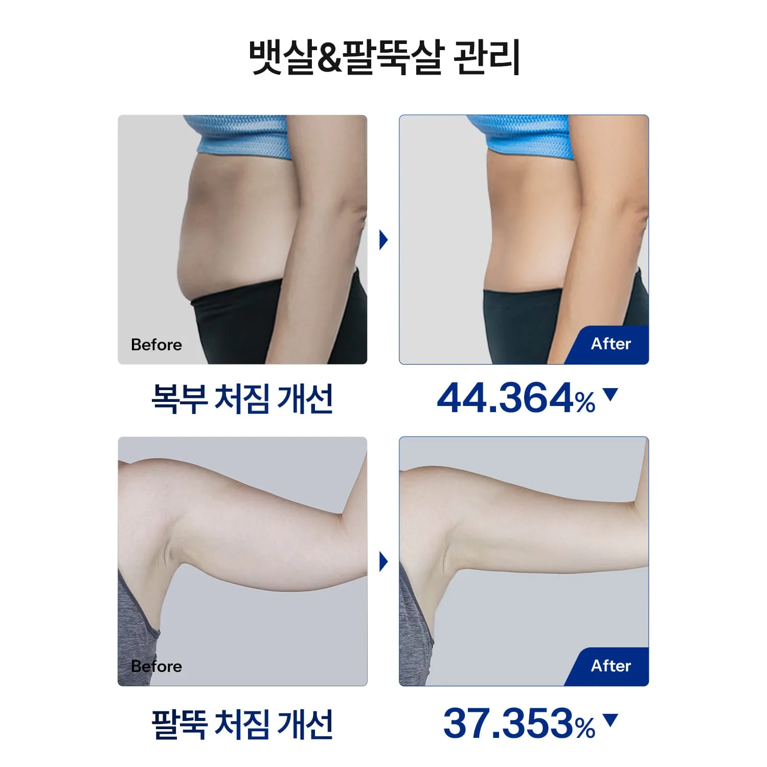 HOMEMODE THERMA LIFT Beauty Device - Image 5
